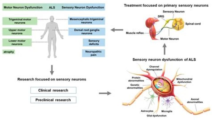 Unveiling The Enigma Of Motor Neurone Disease